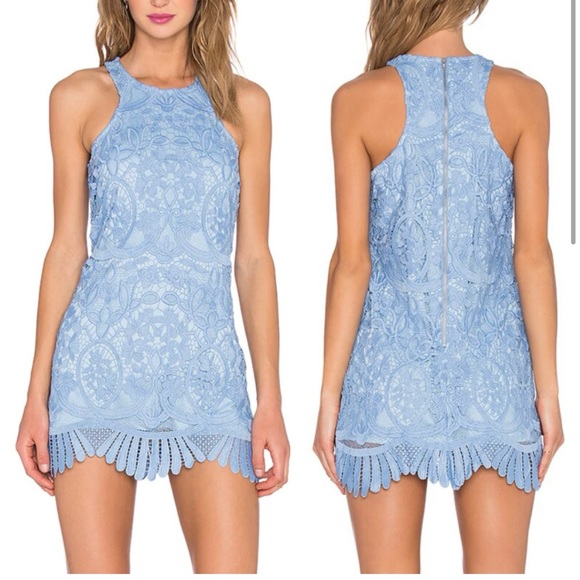 Lovers and Friends blue lace dress - Picture 2 of 6